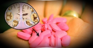 Tapentadol